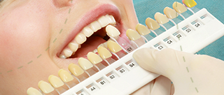  Services Teeth Whitening